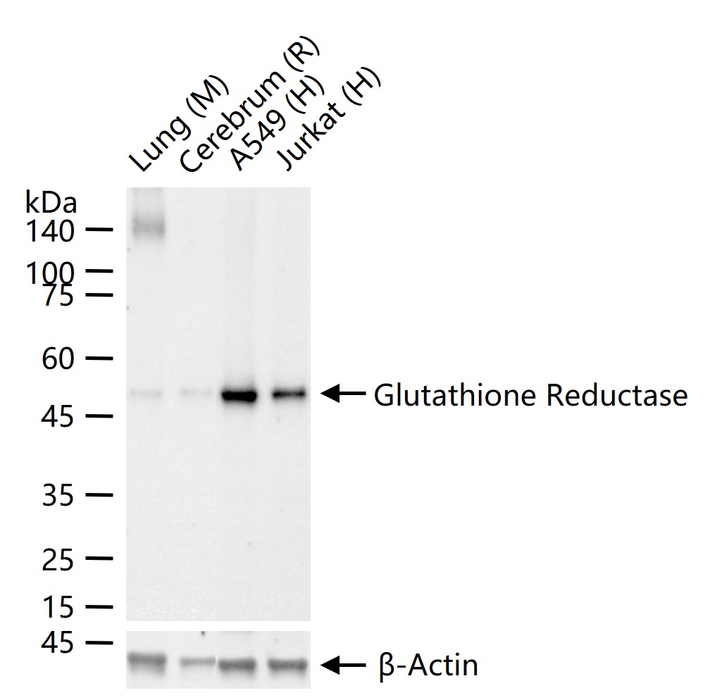 Glutathione Reductase Recombinant Rabbit mAb 谷胱甘肽还原酶重组兔单抗bsm-61572R