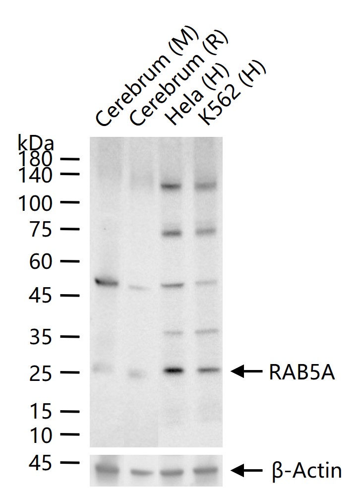 ras癌基因家族Rab5蛋白重组兔单抗-bsm-52451R