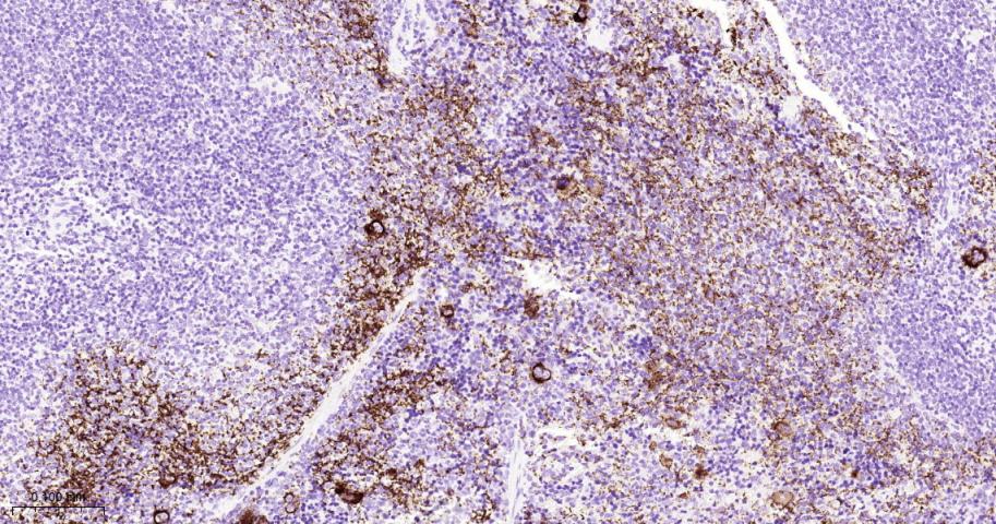 血小板糖蛋白GPIb（CD42b）重组兔单抗-bsm-60017R