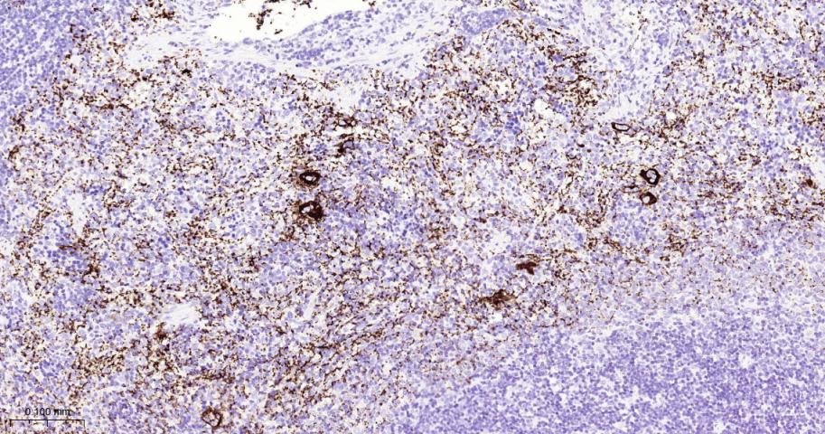 血小板糖蛋白GPIb（CD42b）重组兔单抗-bsm-60017R
