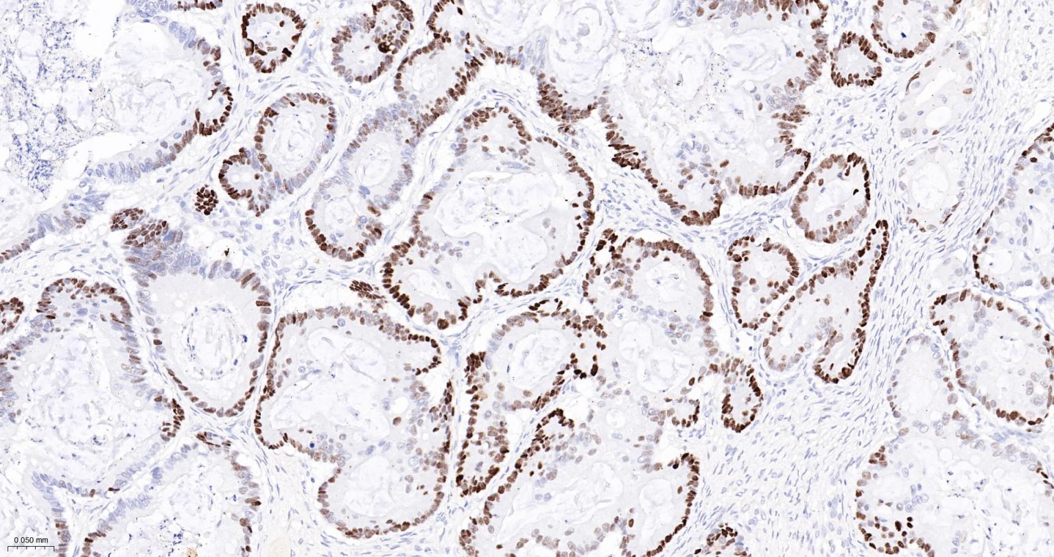 细胞肿瘤抗原P53重组兔单抗-bsm-60806R