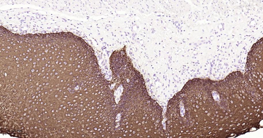 细胞角蛋白16重组兔单抗-bsm-52056R