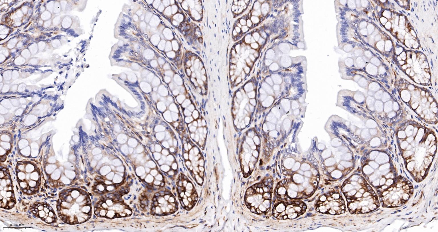 磷酸化真核启动因子2α抗体-bsm-52306R
