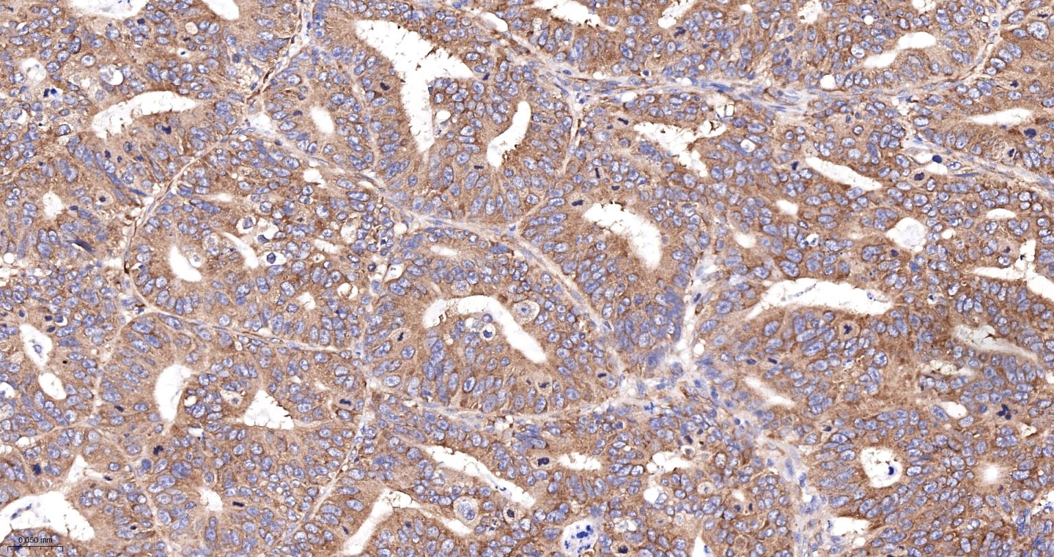 磷酸化真核启动因子2α抗体-bsm-52306R