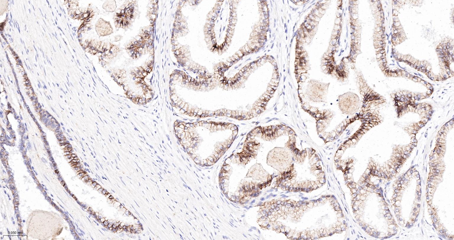 连环蛋白delta-1重组兔单抗-bsm-60229R