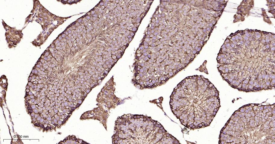热休克蛋白90β/HSP90 β 重组兔单抗-bsm-61128R