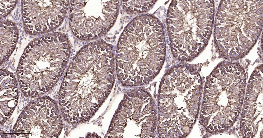 热休克蛋白90β/HSP90 β 重组兔单抗-bsm-61128R