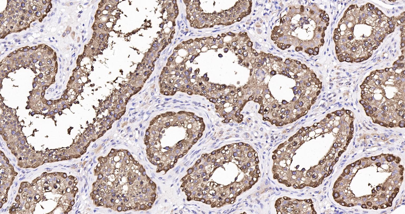 热休克蛋白90β/HSP90 β 重组兔单抗-bsm-61128R