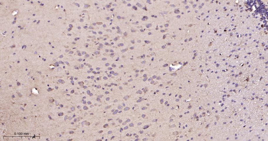 热休克蛋白90β/HSP90 β 重组兔单抗-bsm-61128R