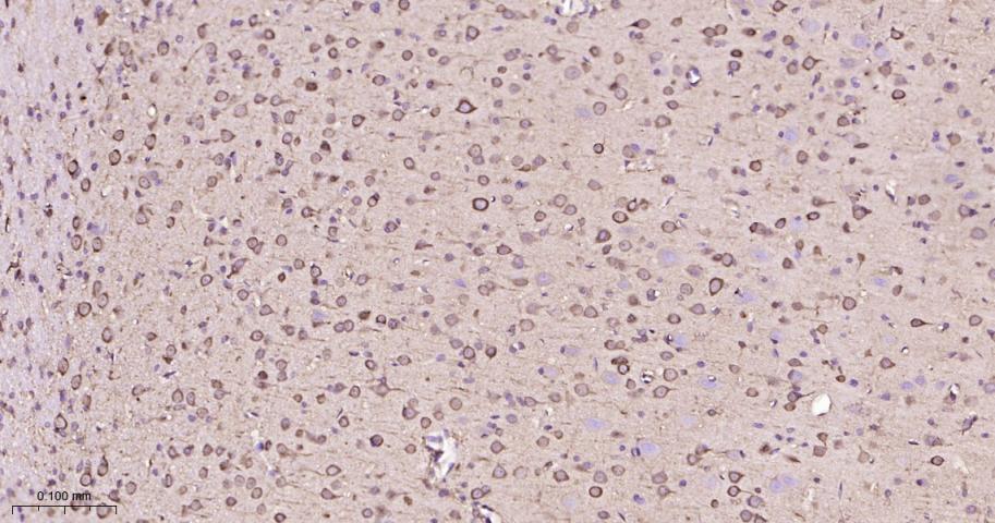 热休克蛋白90β/HSP90 β 重组兔单抗-bsm-61128R