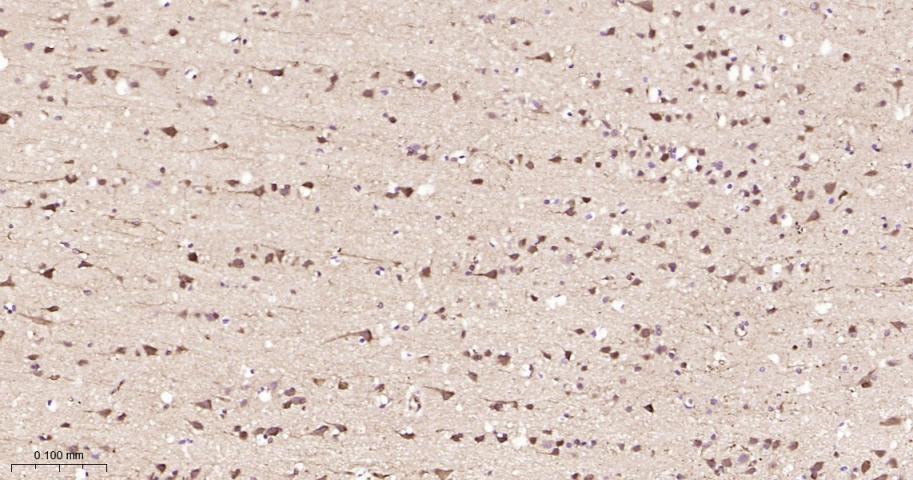 热休克蛋白90β/HSP90 β 重组兔单抗-bsm-61128R