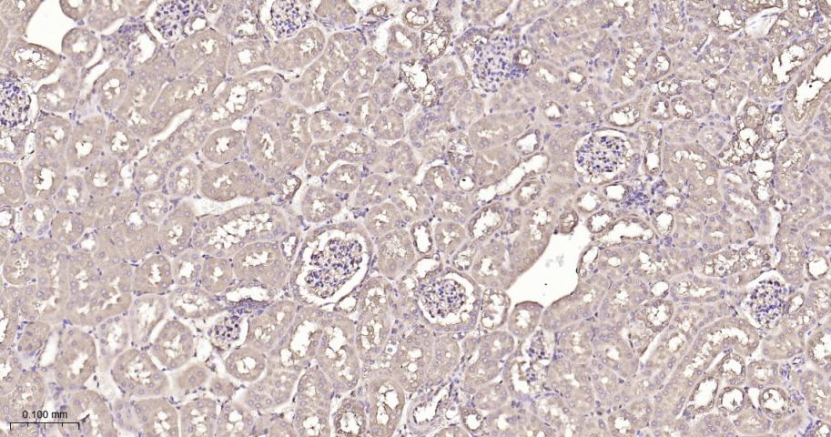 热休克蛋白90β/HSP90 β 重组兔单抗-bsm-61128R