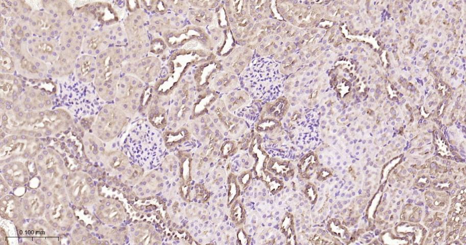 热休克蛋白90β/HSP90 β 重组兔单抗-bsm-61128R
