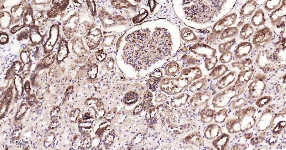 热休克蛋白90β/HSP90 β 重组兔单抗-bsm-61128R