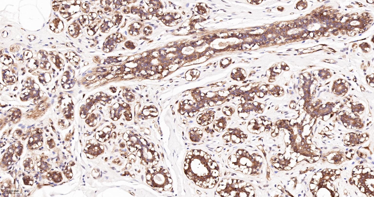 热休克蛋白90β/HSP90 β 重组兔单抗-bsm-61128R