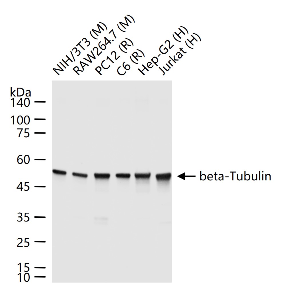 微管蛋白β1 tubulin(内参)重组兔单抗-bsm-33041R