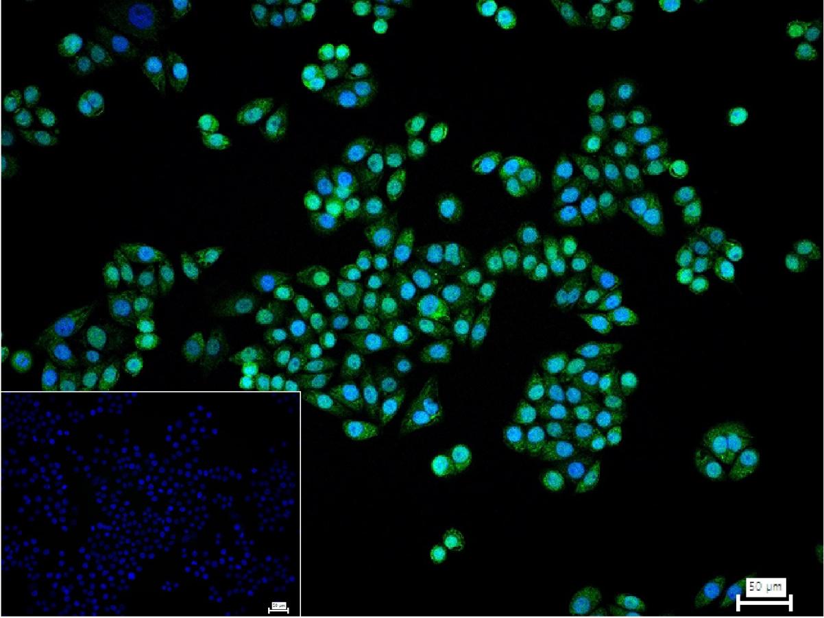 转录调节因子CEBP β重组兔单抗-bsm-61530R