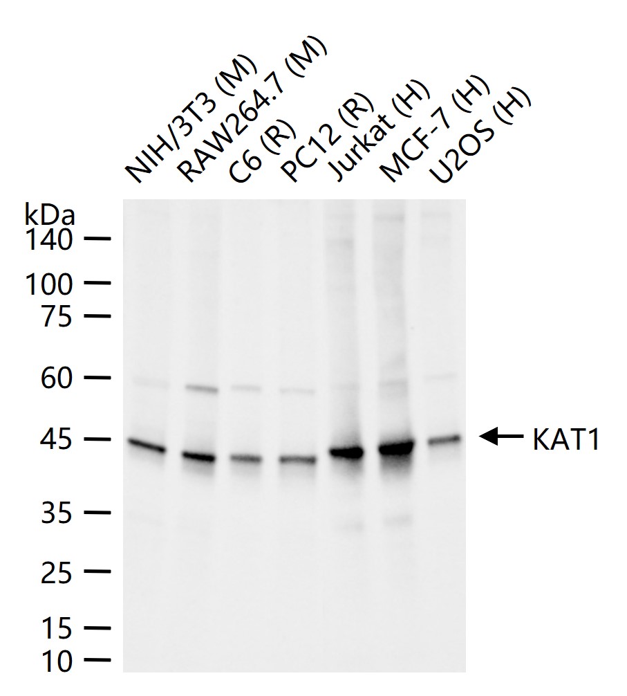 KAT1重组兔单抗-bsm-62022R