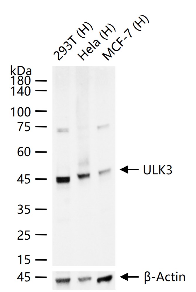 ULK3重组兔单抗-bsm-61618R