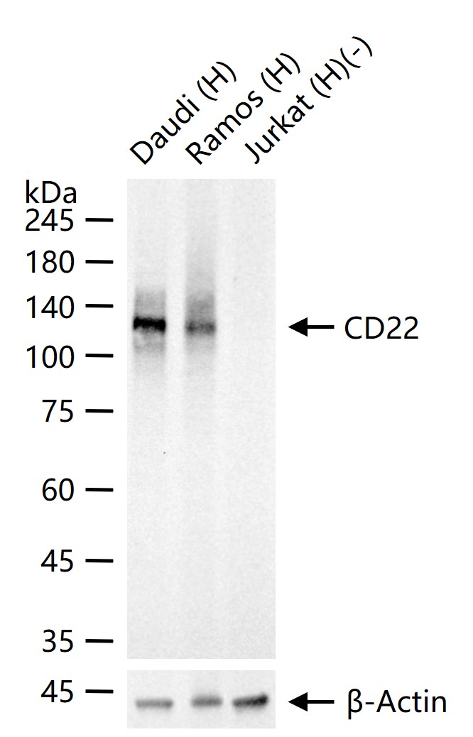 B淋巴细胞粘附分子CD22重组兔单抗-bsm-60233R