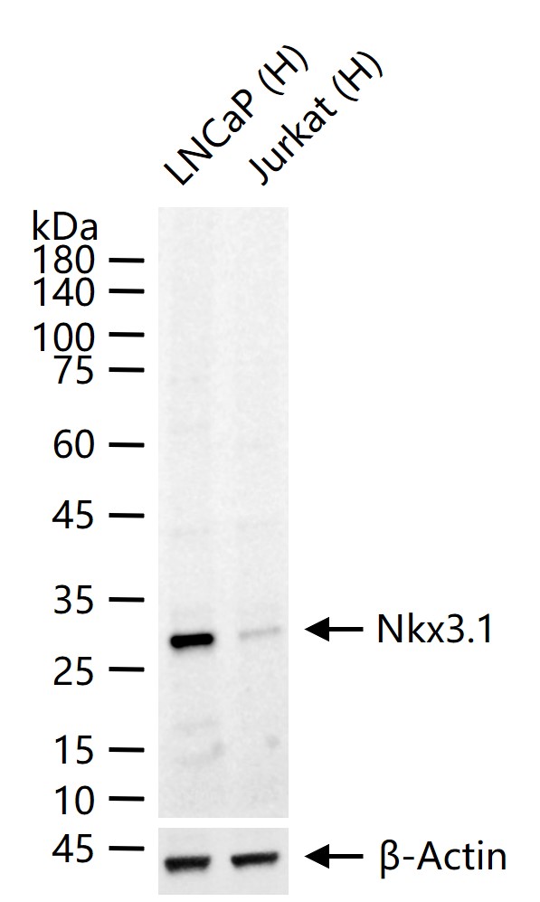 转录因子同源蛋白Nkx3.1重组兔单抗-bsm-61752R