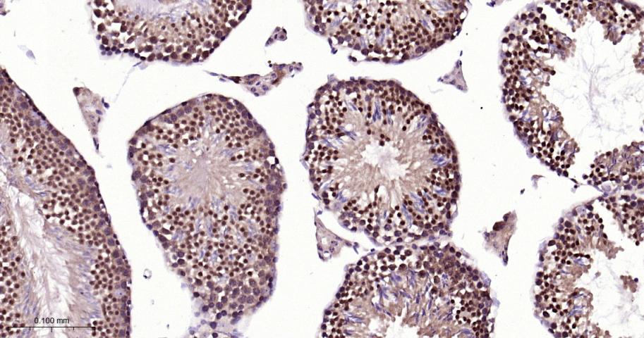 细胞信号转导分子SMAD5 重组兔单抗-bsm-52226R