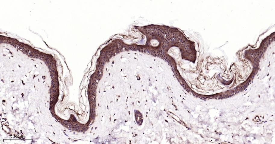 细胞信号转导分子SMAD5 重组兔单抗-bsm-52226R