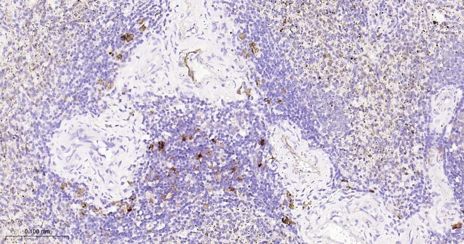泛素结合蛋白P62重组兔单抗-bsm-63328R