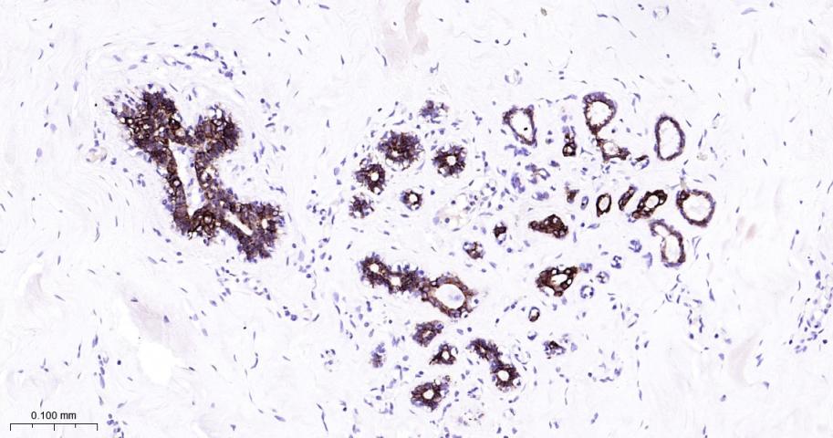 细胞角蛋白7重组兔单抗-bsm-52065R