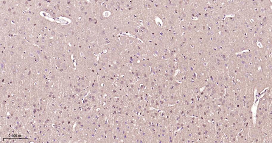 丝裂原活化蛋白激酶1/2重组兔单抗-bsm-52259R