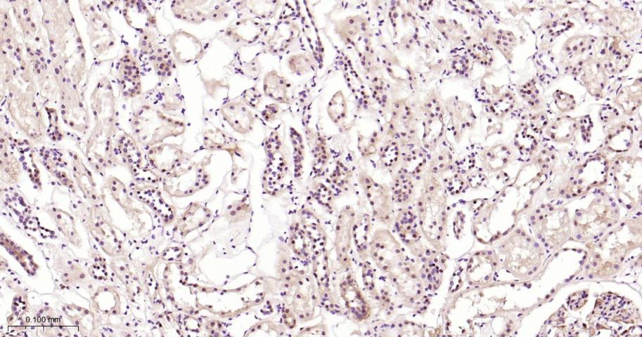 丝裂原活化蛋白激酶1/2重组兔单抗-bsm-52259R
