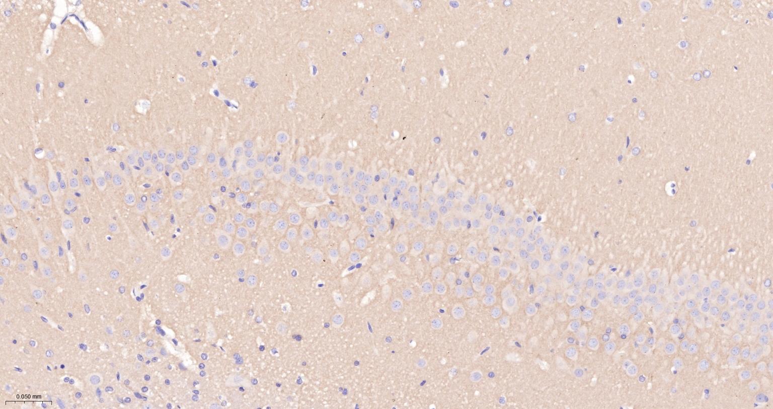 蛋白激酶C α重组兔单抗-bsm-63319R