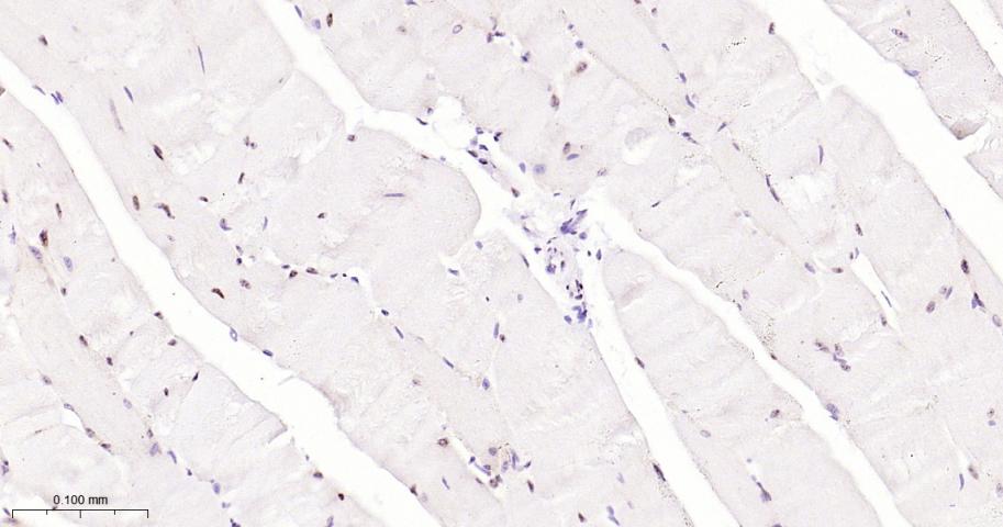叉头蛋白P1重组兔单抗-bsm-52078R