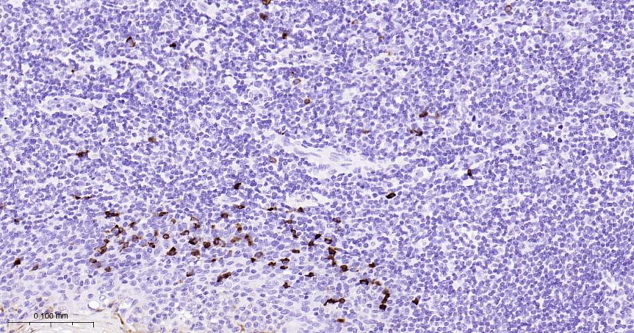人免疫球蛋白A重组兔单抗-bsm-61418R