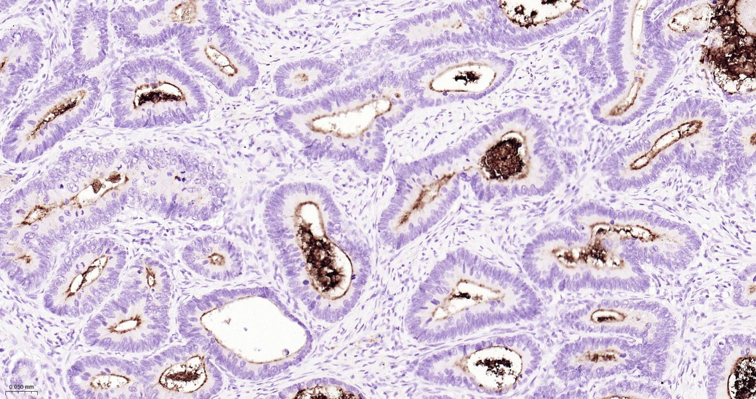 造血干细胞抗原CD133重组兔单抗-bsm-62477R