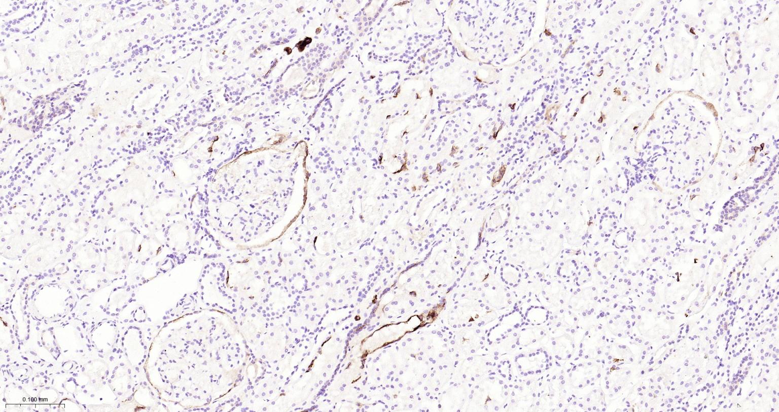 造血干细胞抗原CD133重组兔单抗-bsm-62477R