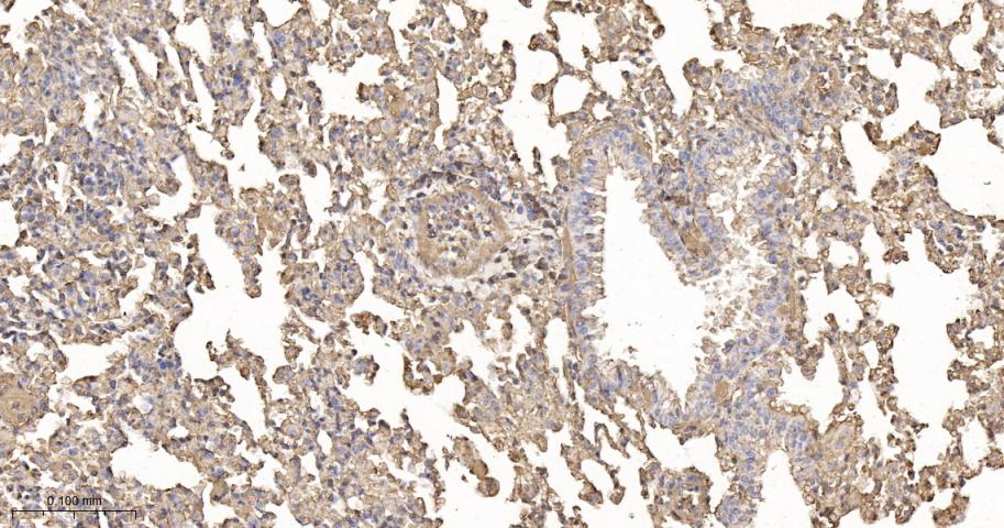 β-肌动蛋白/β-Actin（内参）重组兔单抗-bsm-63325R