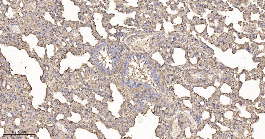 β-肌动蛋白/β-Actin（内参）重组兔单抗-bsm-63325R