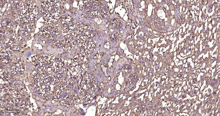 β-肌动蛋白/β-Actin（内参）重组兔单抗-bsm-63325R