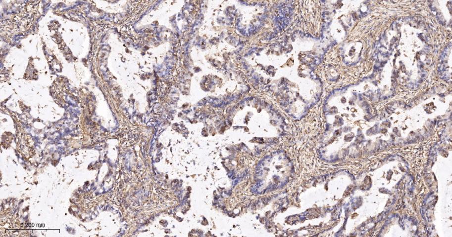 β-肌动蛋白/β-Actin（内参）重组兔单抗-bsm-63325R