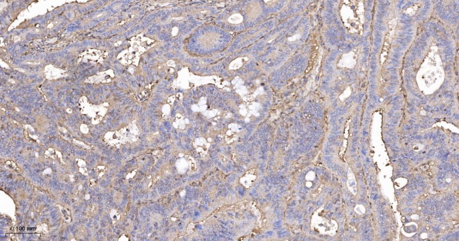 β-肌动蛋白/β-Actin（内参）重组兔单抗-bsm-63325R