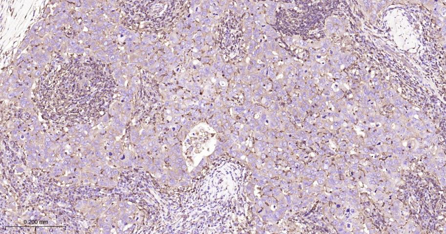 β-肌动蛋白/β-Actin（内参）重组兔单抗-bsm-63325R