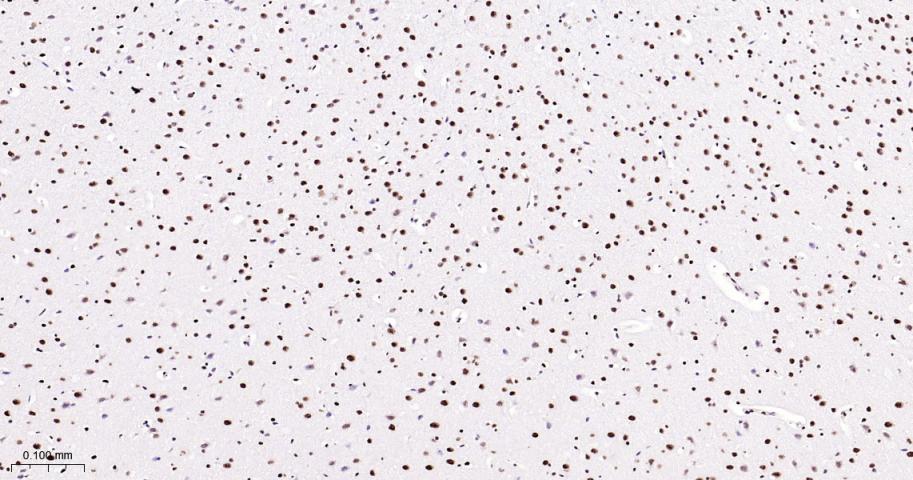 磷酸化p38 MAPK重组兔单抗-bsm-55528R