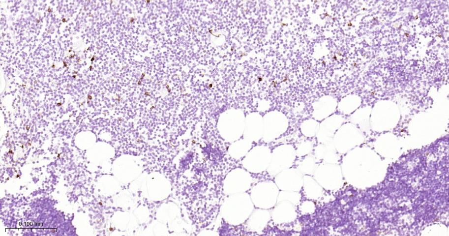 CD134重组兔单抗-bsm-60298R