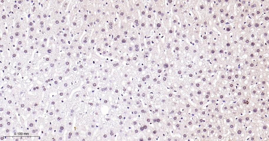 磷酸化p38MAPK重组兔单抗-bsm-63316R
