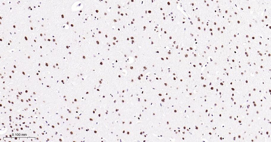 磷酸化p38MAPK重组兔单抗-bsm-63316R