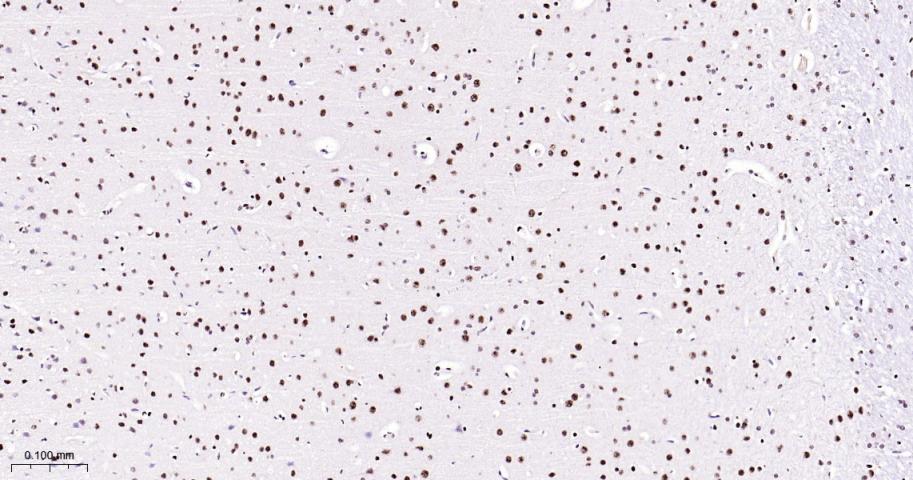 磷酸化p38MAPK重组兔单抗-bsm-63316R