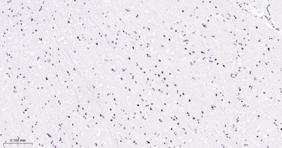 磷酸化p38MAPK重组兔单抗-bsm-63316R
