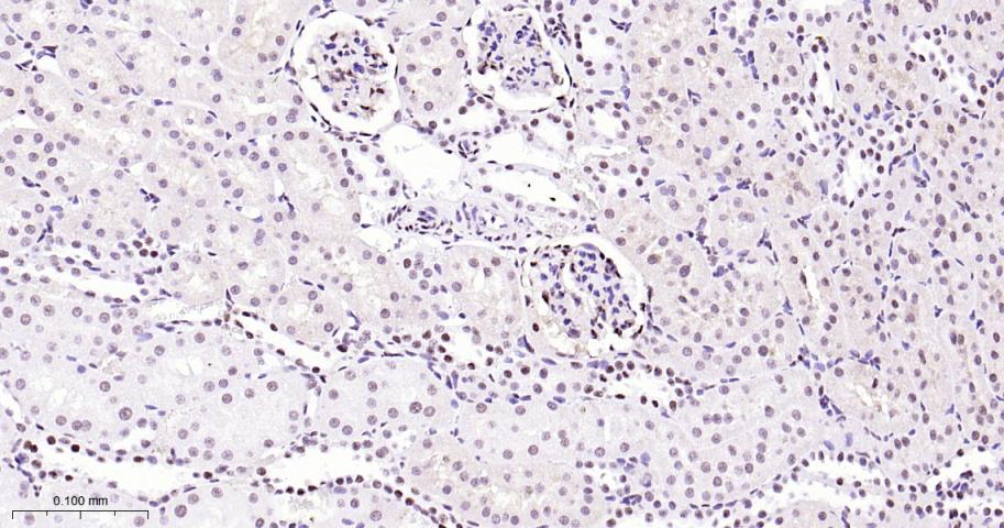 磷酸化p38MAPK重组兔单抗-bsm-63316R