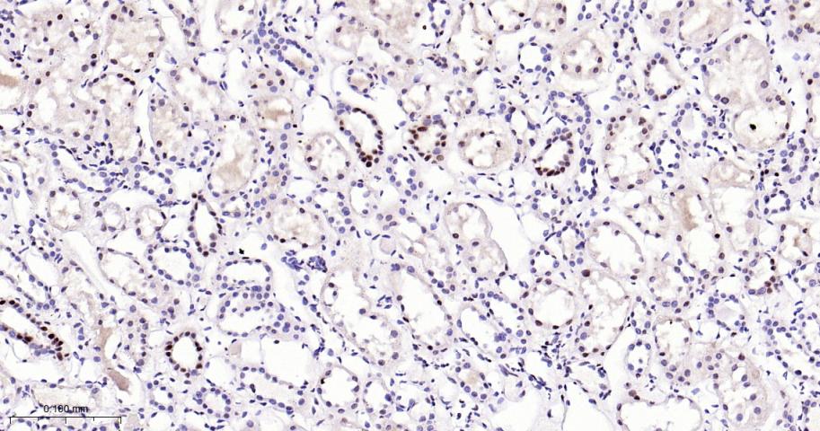 磷酸化p38MAPK重组兔单抗-bsm-63316R